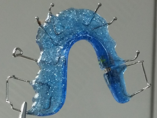 Spreekbeurt over Beugels